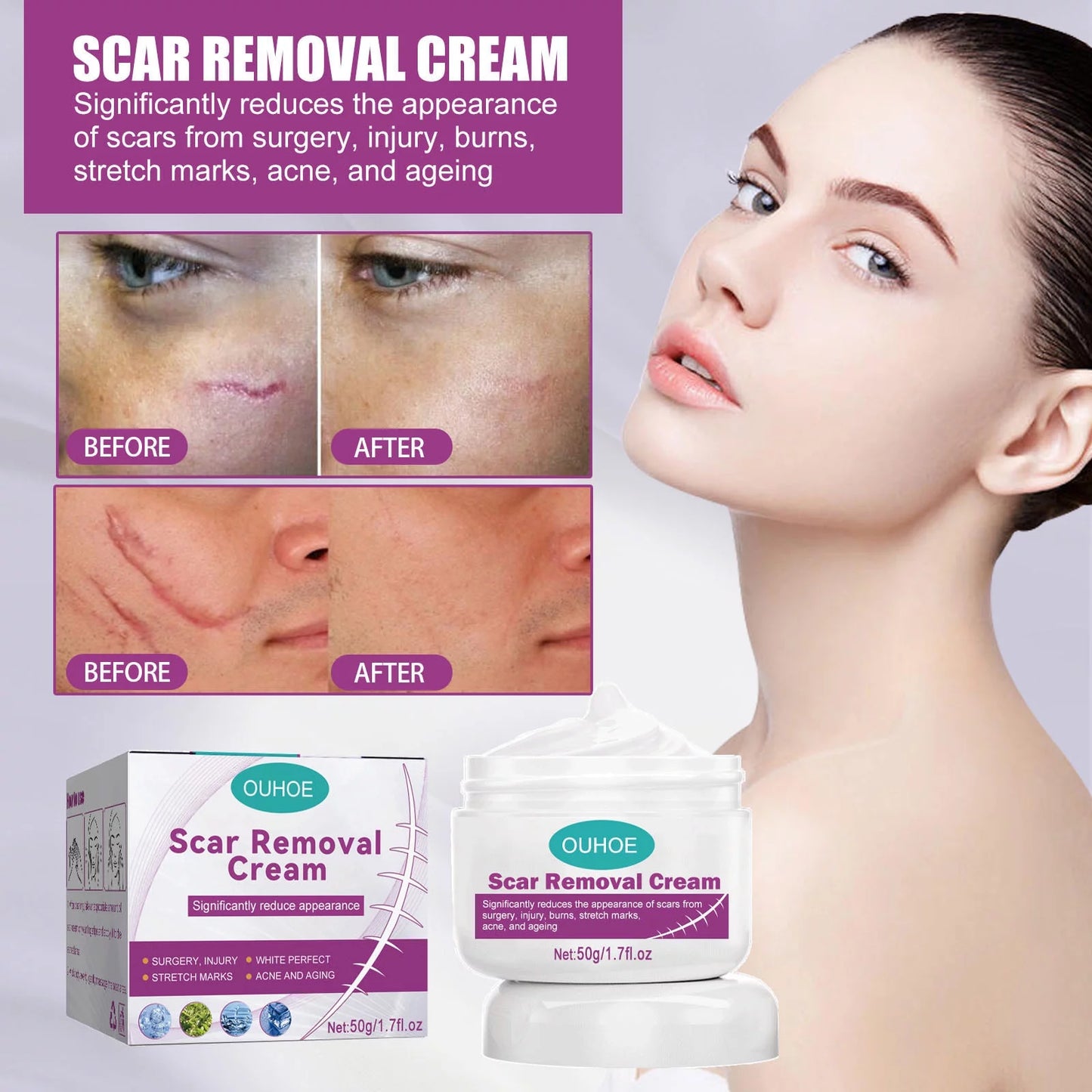 Cream Removal Cream 2PCS Scar 50ml and Repair Removal Repair Scar Scar Skin