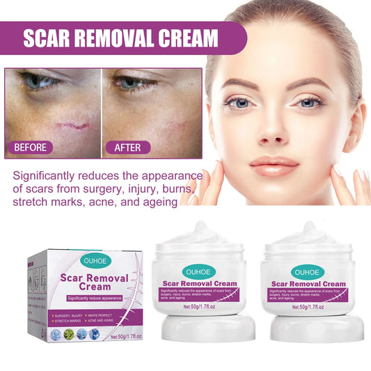 Cream Removal Cream 2PCS Scar 50ml and Repair Removal Repair Scar Scar Skin